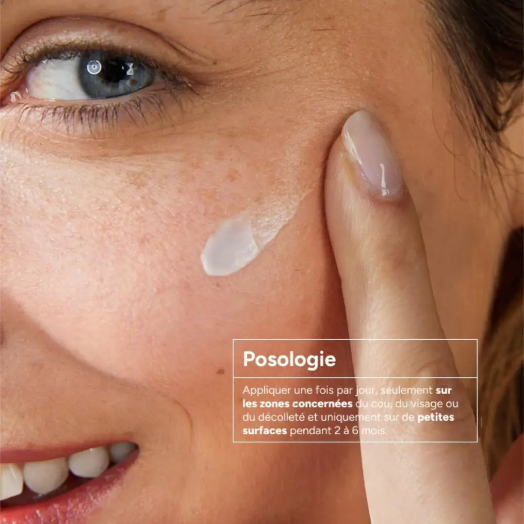 كريم إزالة البقع والتصبغات من إيه سي إم بنتائج مثبتة