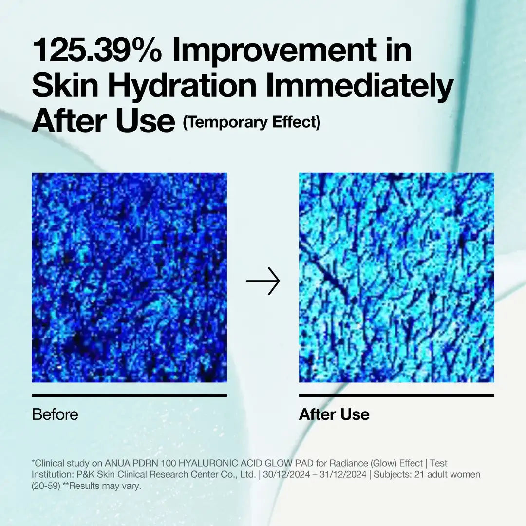 وسادات مرطبة بحمض الهيالورونيك من انوا كوريا