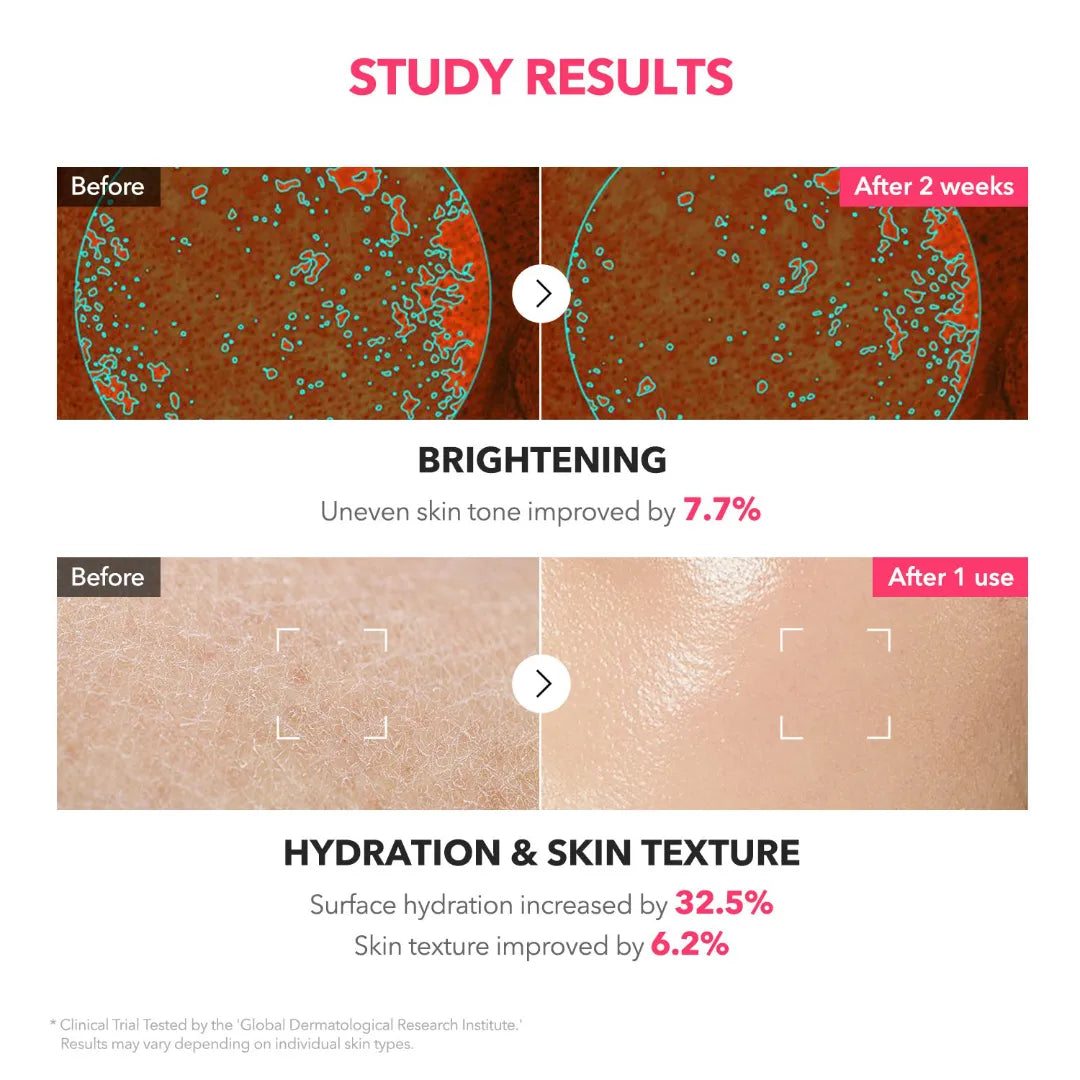 تونر كريمي من ابريل سكين للبقع الداكنة والتصبغات