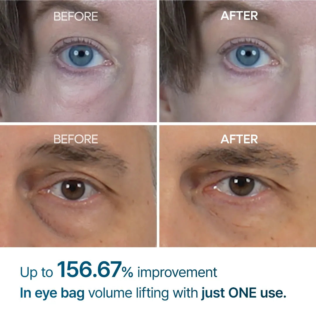 كريم التقليل من انتفاخات العين بقوة سريرية من دكتور ميلاكسين