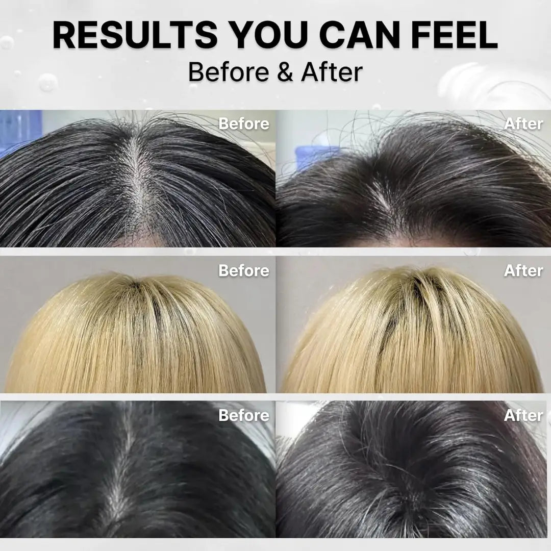 Grow:Turn Exosome 3D Volume Shampoo by Lilyeve — Olive Young #1 Anti-Hair Loss