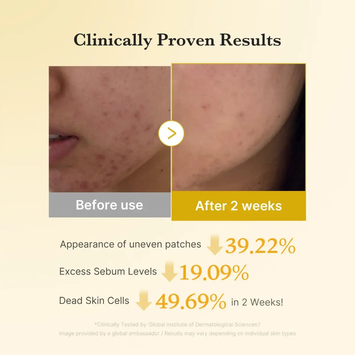 وسادات ميديكيوب المفتحة والمقشرة بحمض الجلايكوليك