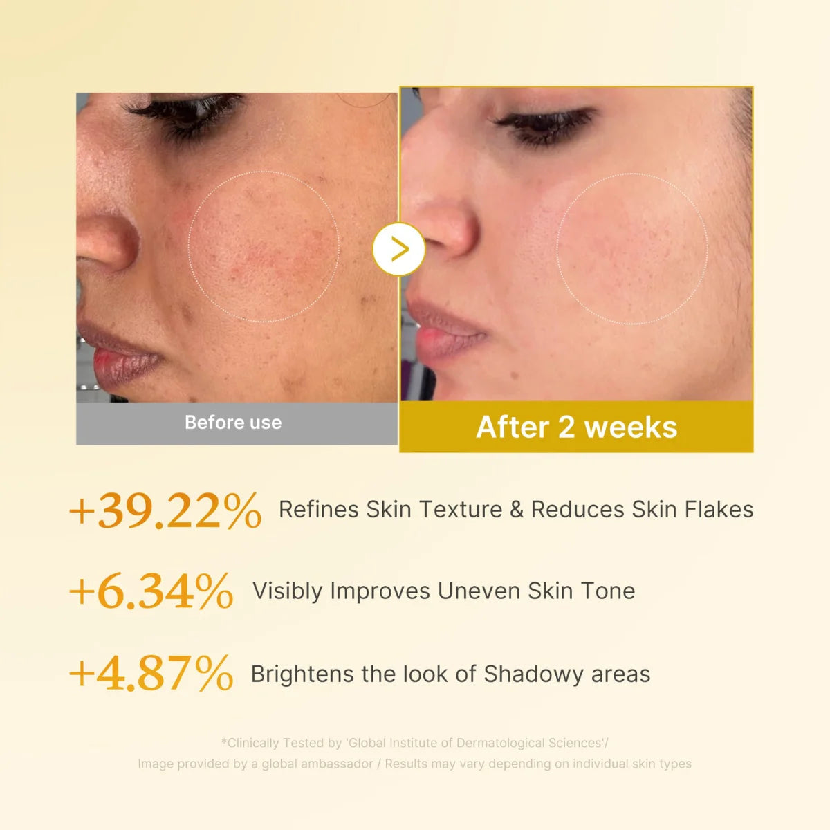 ميديكوب تونر تفتيح بالجليكوليك اسيد والنياسيناميد