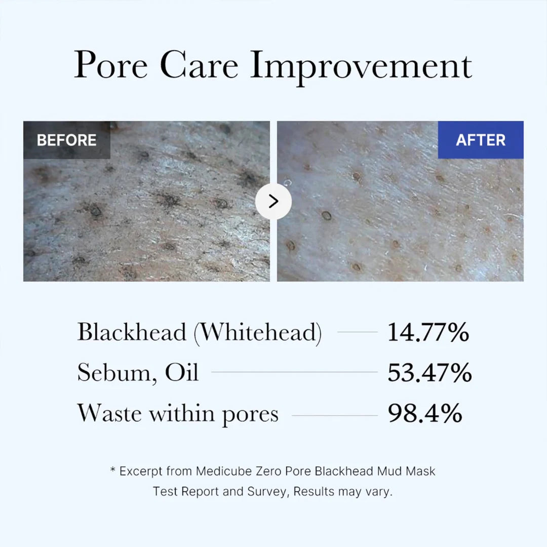 قناع طين ميديكيوب سريع الجفاف 3 دقائق لعلاج الرؤوس السوداء