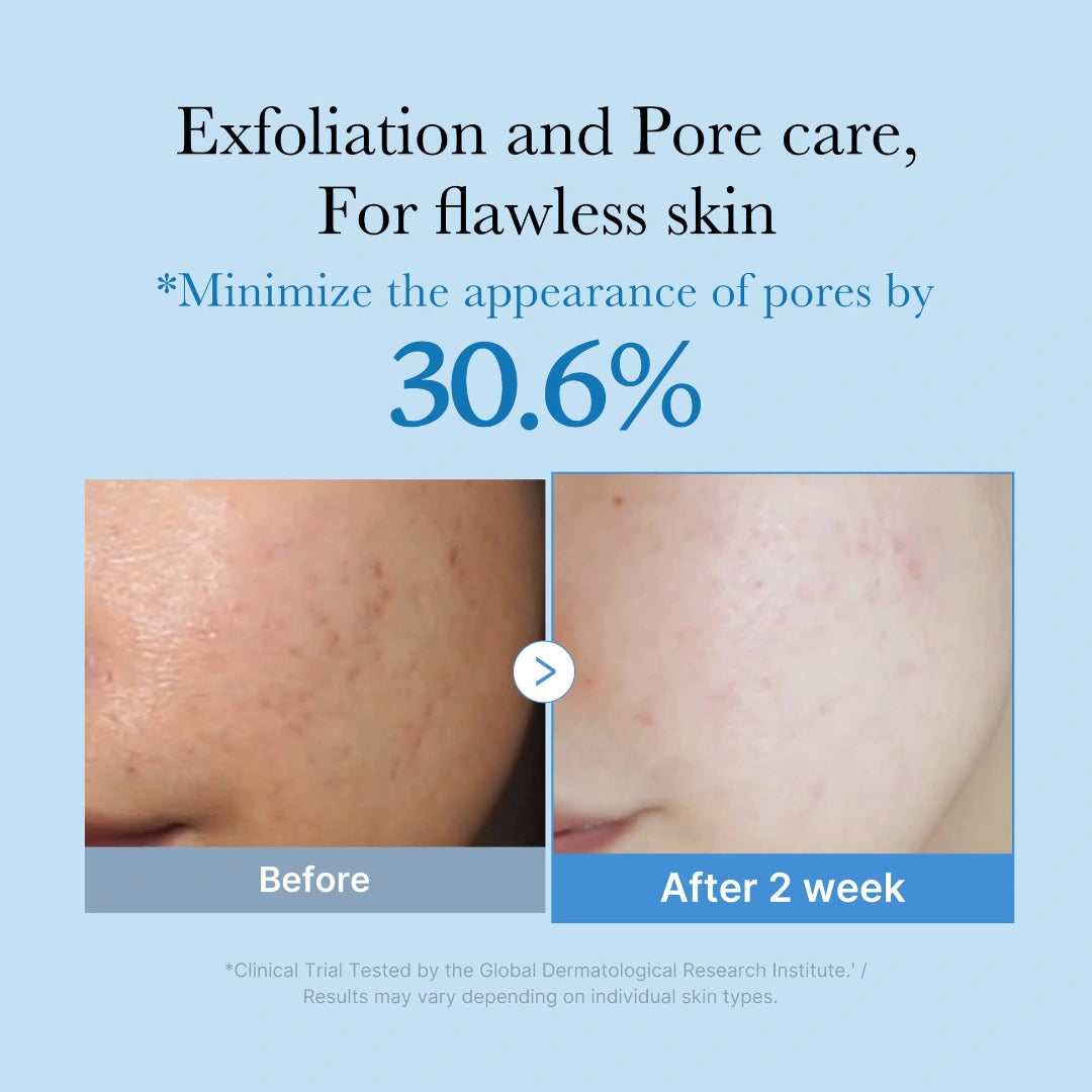 تونر المسام الكوري ميديكيوب بأحماض التقشير للبشرة الدهنية