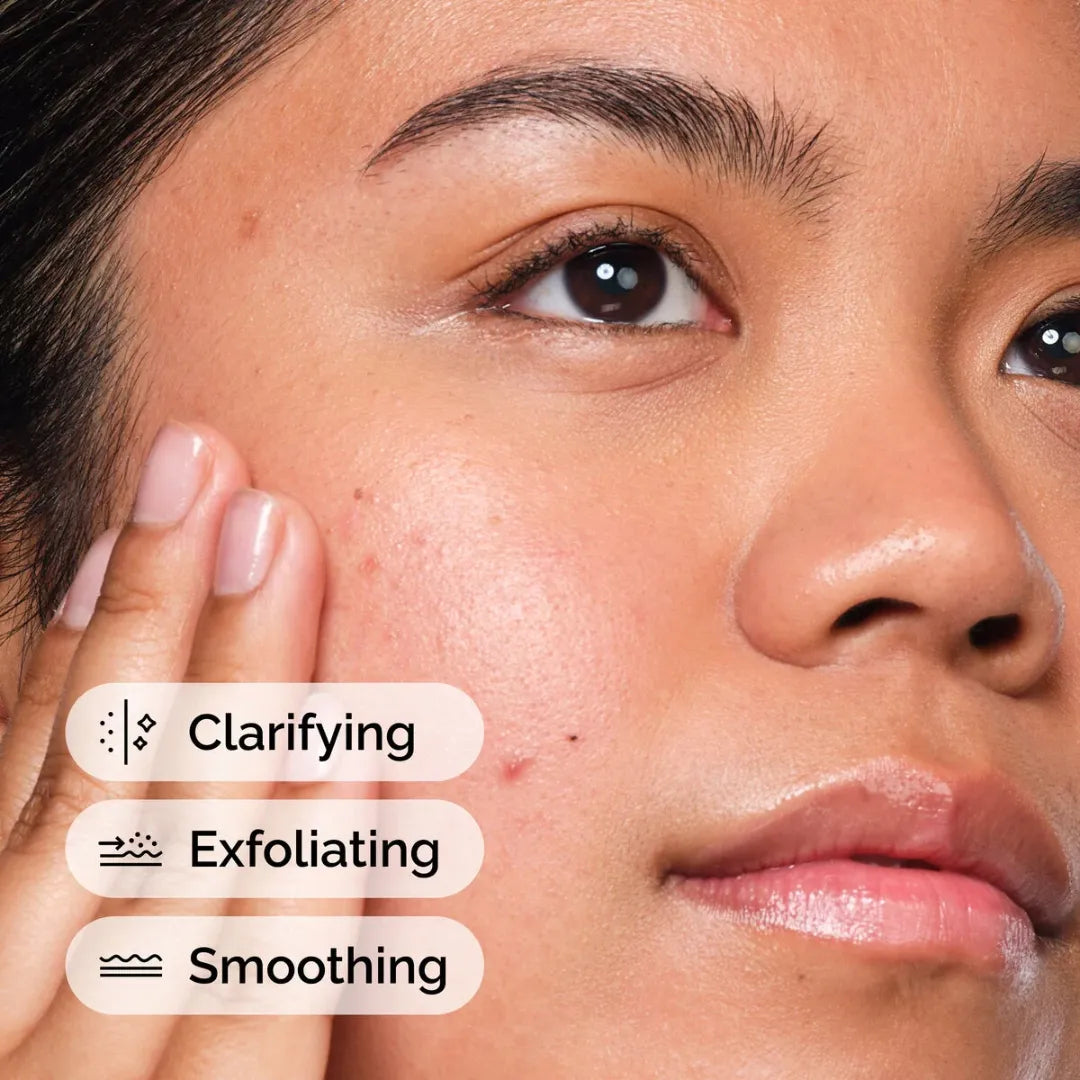 سيروم ذا اورديناري بحمض الساليسيليك 2٪ للبشرة المعرضة لحب الشباب