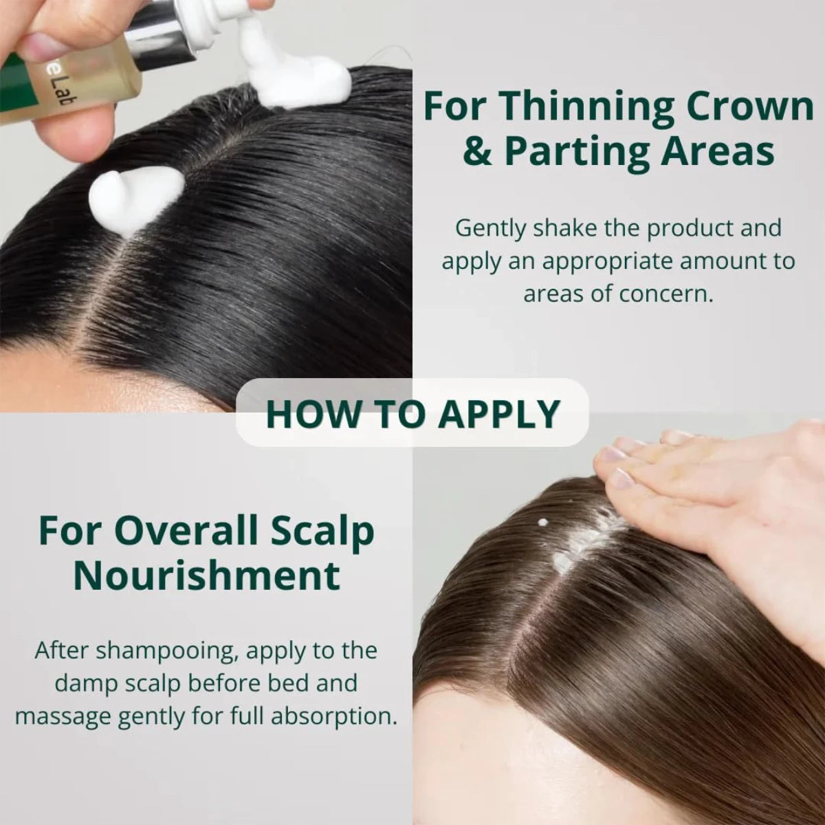 علاج فروة الرأس النباتي من فايف لاب لترقق الشعر