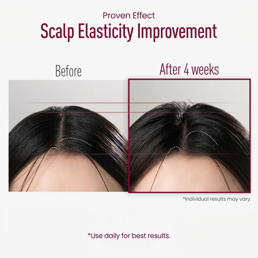 React Shot 400 by ViveLab – Deep Scalp Treatment with 220,000 Microneedles