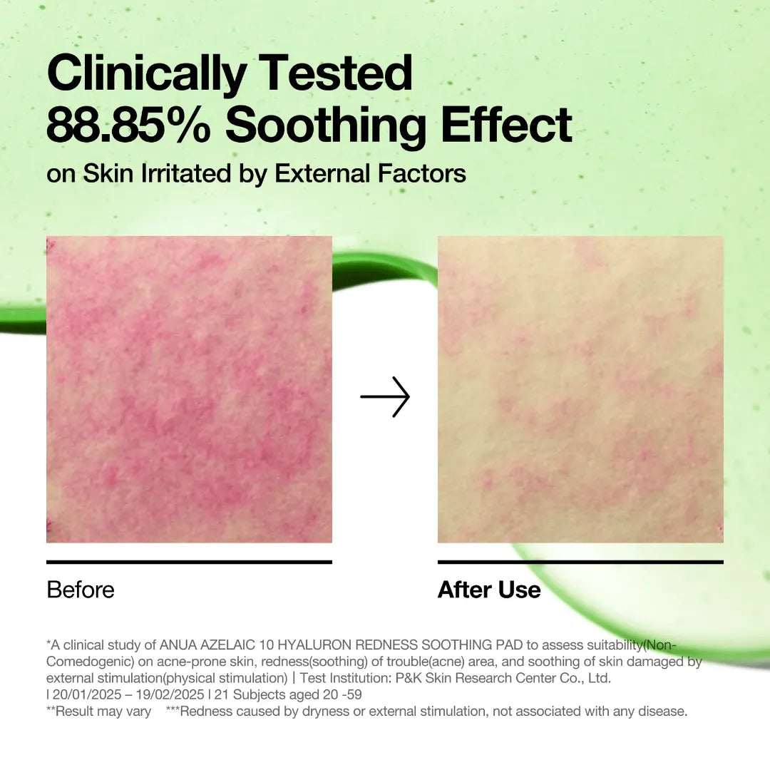 وسادات تونر قابلة للتمدد من انوا للبشرة المعرضة لحب الشباب