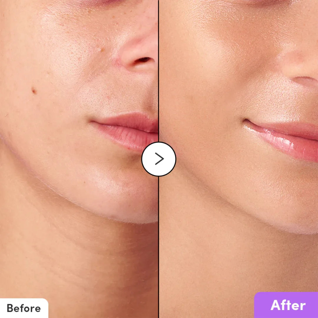 إيكوال بيري تونر باكوتشيول بالكبسولات مضاد للشيخوخة