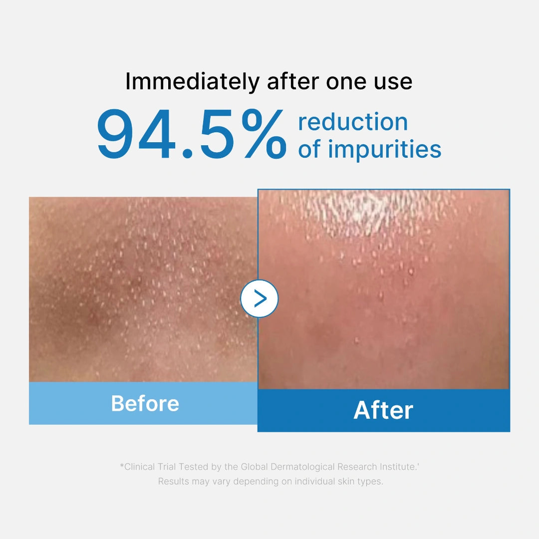 زيت تنظيف كوري من ميديكيوب للرؤوس السوداء والدهون الزائدة