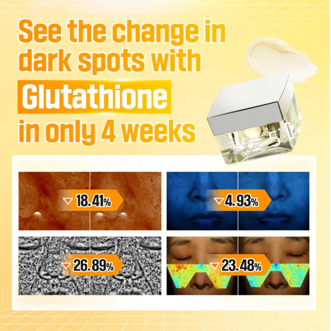 كريم نومبوزن للبقع الداكنة مع 8 عوامل نمو لتفتيح البشرة