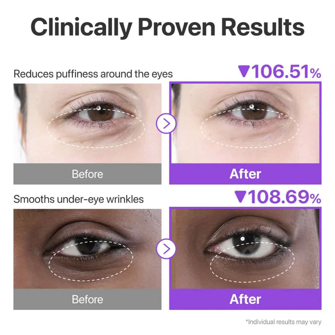 وسادات هيدروجل بالكولاجين من نومبوزين للعيون المتعبة