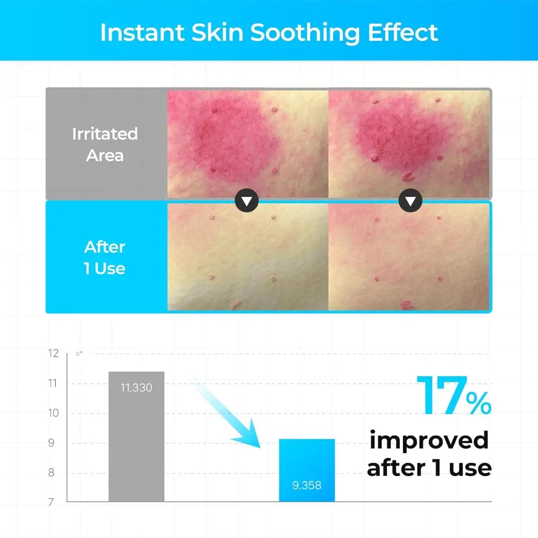 تونر مياه الجليد سيبوري شافيك تركيبة مهدئة مثبتة سريرياً