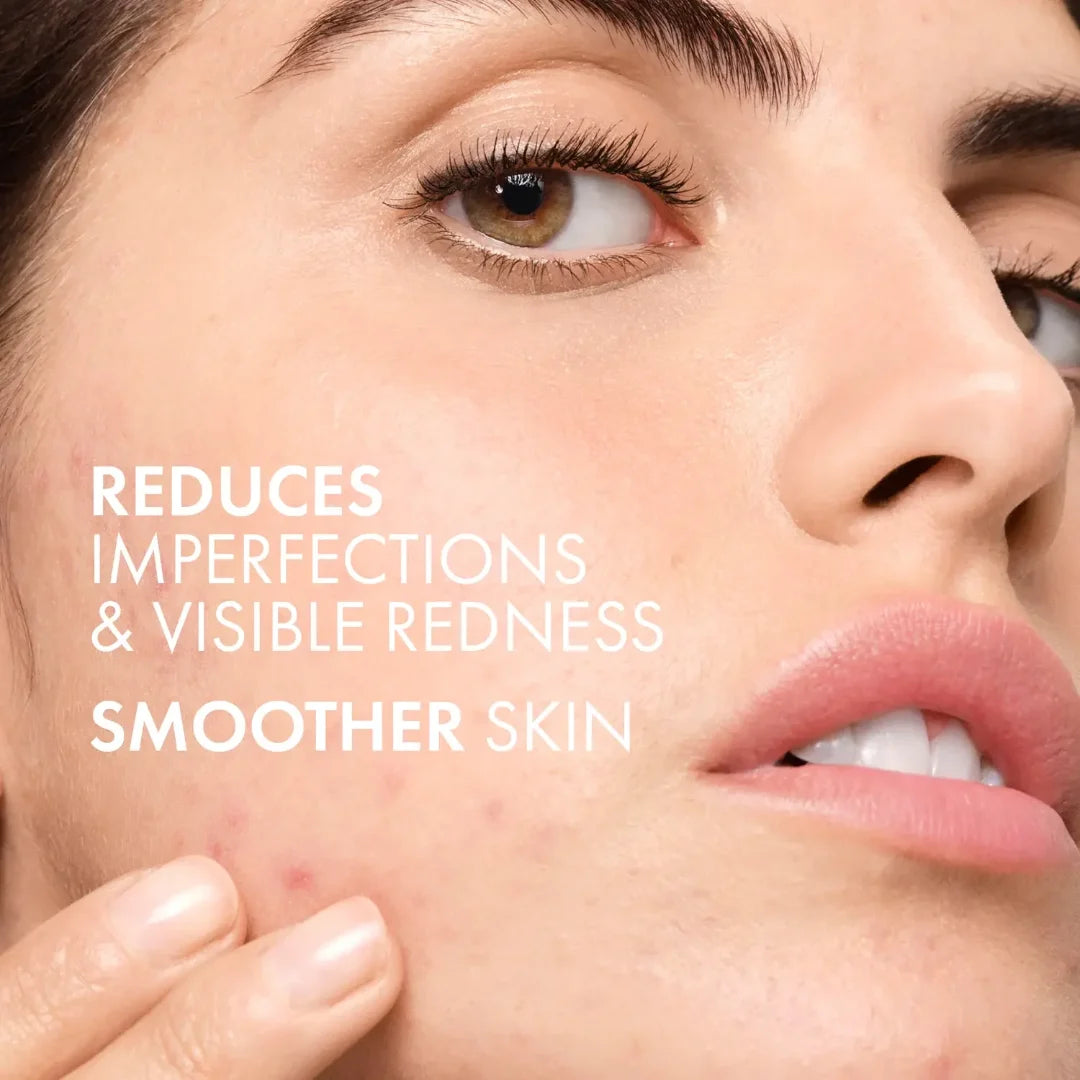Vichy Normaderm 3-in-1 Cleanser Scrub Mask 125ml for Acne-Prone Skin