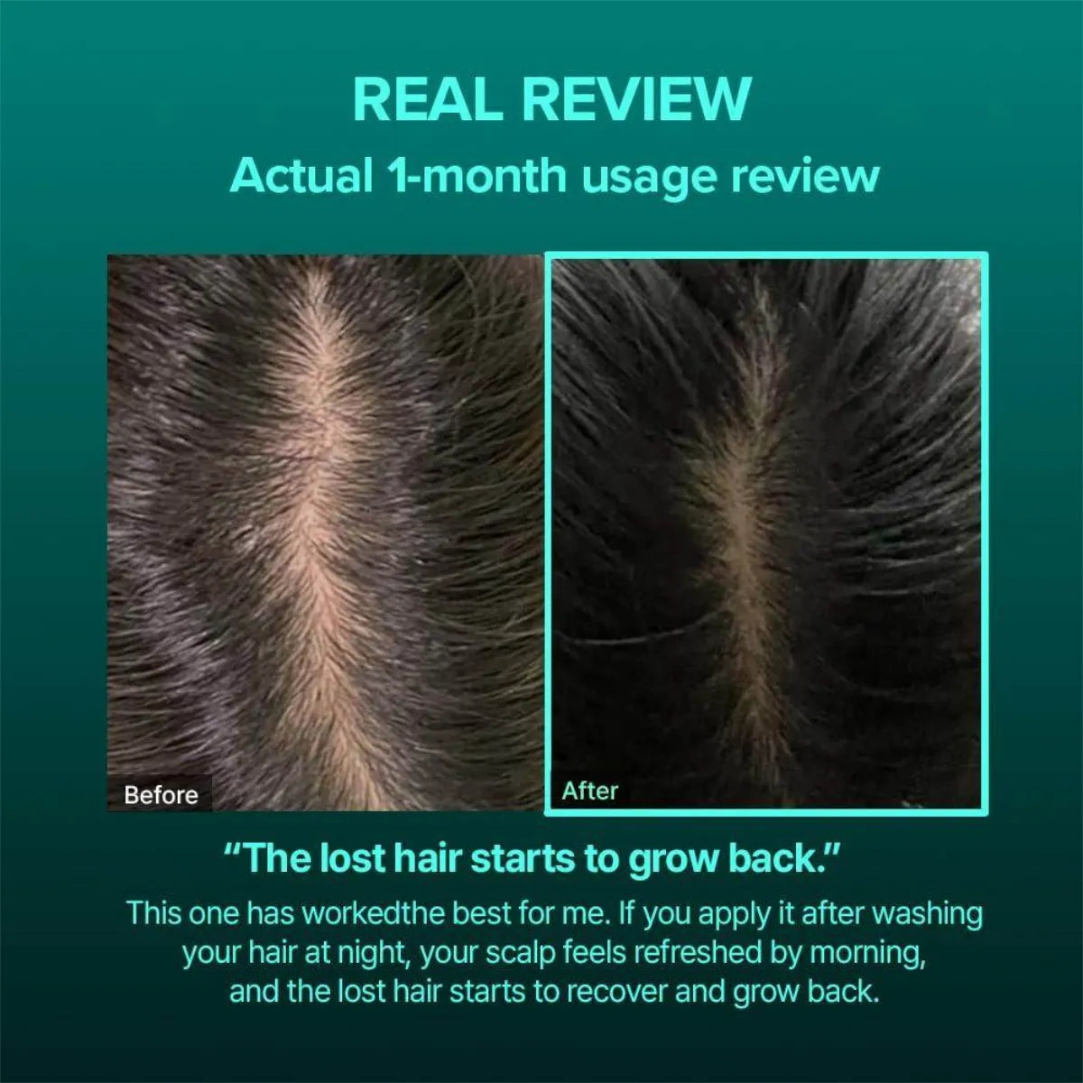 علاج فروة الرأس بالبروتين والكافيين من فيف لاب